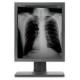 4096 Gray scale Medical Grade Displays G51SP Has five million pixels