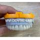 Ivoclar Emax Laminate Veneers Translucent Professional High Level China Dental Lab