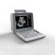 Full Digital OB GYN USG Scan Machine 0 To 120dB 12in Led Display