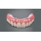 Dental All On 4 Implant Supported Dentures Professional Natural Looking