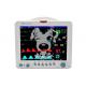 5 Parameter Patient Monitor Pet Use Multi Parameter Monitoring System for Vet Animal Patient Monitoring Devices