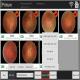 Manual Digital Fundus Camera Ophthalmology Coherence Tomography