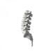 5×11mm 6×11mm Spine Spinal Fusion Cage Interbody Fusion Cage