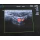 GE Logiq E9 ML6-15-D Breast Ultrasound Probe Repair Linear Vascular Transducer