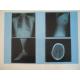 KND-A Low Fog Medical Dry Imaging Film For X Ray Examination On AGFA 5300 / 5302 / 5500