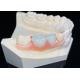 OEM Invisible Removable Dentures Custom Acrylic Resin Partial Dental Prosthesis