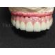 Titanium / Zirconia Implant Crown Polished Finish Artificial Dental Crown