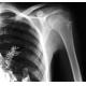 Agfa / Fuji Medical X-Ray Film , Radiography Portable Laser Printer Film
