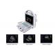 B Ultrasound Scanner Portable Doppler Ultrasound Machine with Only 4.5Kgs Weight