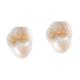 All-Ceramic FDA 3014652903 Zirconia Dental Crown Veneer Inlay Onlay