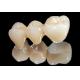 All Ceramic Zirconia Dental Crown