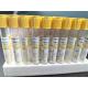 JINGZ Medical Vacuum Blood Collection Tube 2-10ml Gel Clot Activator Tube With Yellow Top