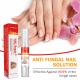 GMP Nail Repair Pen For Damaged Fungal Infection Anti Fungal Treatment
