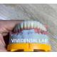 Digital Cement Dental Bridge Implant Translucency FDA Certified