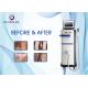 Multifunctional Diode Laser Beauty Machine For Hair Removal / Skin Rejuvenation