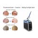 Vertical Picosecond Laser Tattoo Removal Machine Pigmentation Removal Acne Treatment