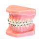 Dental Braces Fixed Orthodontic Appliances Upgrade Soft Wire Brackets