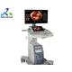 GE Voluson S10 BT18 5852115 Video Card Parts Ultrasound Machine