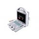 Full Digital Color Doppler Machine Color Ultrasound System Scanner With Multi-frequency Probes