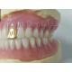 Customizable Full Denture Acrylic Teeth Odor Resistant Comfort Fit