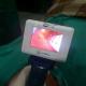 Reusable Portable Video Laryngoscope Glidescope For Intubation 2.5'' Display
