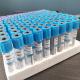 Vacuum Type Sodium Citrate Blood Sampling Tube 9NC In 100/Box