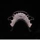 Perfect Fit Germany Ortho Teeth Halley Retainer for Esthetics and Adjustability