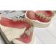 Hot Cured Removable Aesthetic Lower Partial Acrylic Denture