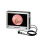 Medical Portable Endoscope Camera System 15 HDMI SYNC