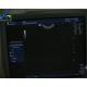 GE E8C 11.5 MHz Medical Ultrasound Probe Ospital Intracavity Transducer