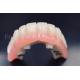 Customized Dental Implants Crowns Replacement Wear Resistance
