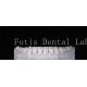 High Durability Natural Looking Teeth Veneers 0.3mm-0.5mm Thickness