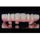 Individual All On 4 All On 6 Dental Implants Restores Full Chewing Ability