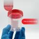 Disposable Specimen Cups| High-Grade Silicone, Sterile, Individually Wrapped Medical Cups W/Leakproof, Screw-On Lids