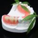 High Esthetics Dentsply Lucitone 199 Acrylic Denture acrylic resin for dentures China Dental lab