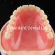 Full acrylic denture acrylic resin for dentures acrylic complete denture China Dental Lab