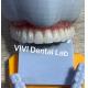 Translucency Digital Dental Crowns Teeth High Esthetics Customized