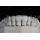 Polished Dental Laminate Veneers High Translucency For Natural Looking Smiles