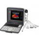 Electric Laptop BB 4B PWD mode Ultrasound Scanner Machine for Hospital