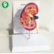 Pathology Human Renal Anatomy Model Health 18X14X12 Cm Single Package
