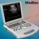 Medical Device Portable Ultrasound Scanner in Hospital