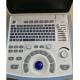 Medical Full Digital PC Based Ultrasound Scanner Machine B/B  B/M Mode