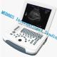 15 Inch High Definition LED Screen Handheld Ultrasound Scanner Machine with Built-in Battery