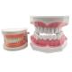 Laboratory Dentures Dental Filled Dental Implants Complete Restorative Overlays Denture