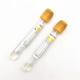 Glass PRP SST Blood Test Tube With Separating Gel Customized