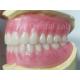 OEM Full Upper And Lower Acrylic Denture Stain Resistance  Natural Color