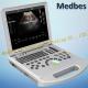 Cardiac/Vascular/Ob/Gyn Portable 3D 4D Echo Color Doppler Ultrasound Scanner