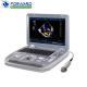 Portable continuous doppler cardiac inspection 3d 4d echocardiograph