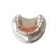 Comfortable Wear Dental Orthodontic Appliances