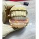 Tooth Temporary Dental Implant Crown PMMA Biocompatible Ni Be Free